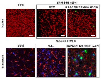알츠하이머병 쥐의 신경세포(위 가운데)는 정상쥐(위 왼쪽)에 비해 그 수가 적지만, 연구팀이 개발한 나노입자를 주입하면 신경세포의 수가 정상 수준으로 회복된다. 또 신경염증 역시 감소함을 확인했다. - 기초과학연구원(IBS) 제공